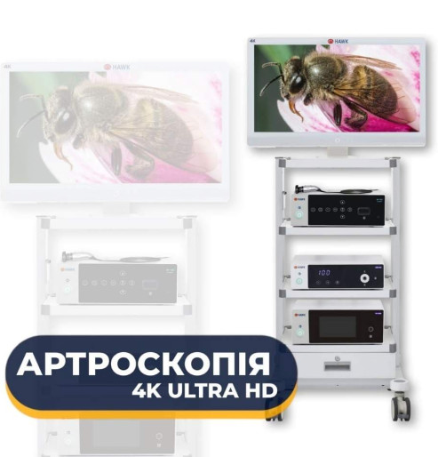 Ендоскопічна артроскопічна стійка 4K Ultra HD 